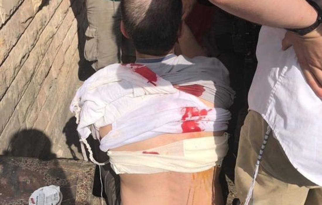 İntikam Saldırısı: 1 İsrailli Yaralı