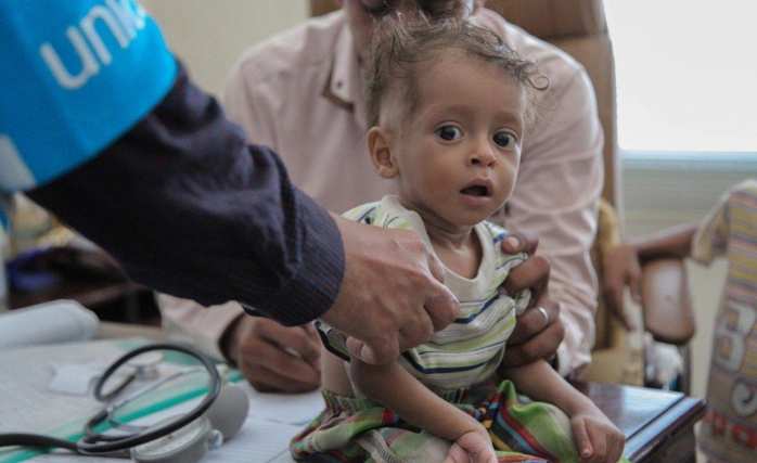 Yemen’de Kolera Salgını